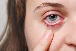 eye infection from contact lens